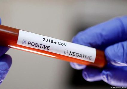 Great efforts are made to get COVID 1-9 examination samples