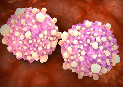 New blood test could detect plenty types of cancer