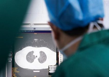 Asymptomatic coronavirus patients’ lungs could be damaged