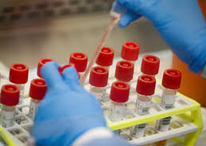 11 coronavirus new cases confirmed in Palestine, total 495