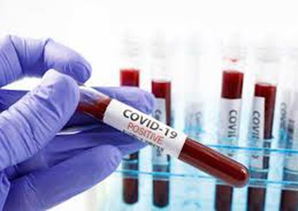 24 new coronavirus cases in West Bank .Total to 769