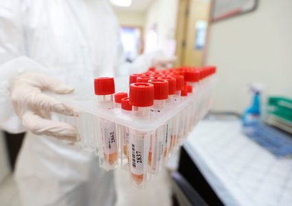 One death and 97 new cases of COVID-19, in the West Bank