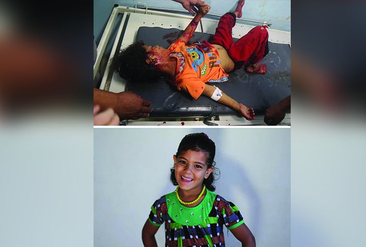 Before and After: Victims of the Israeli occupation attacks on Gaza Strip.
Credit to: Belal Khaled