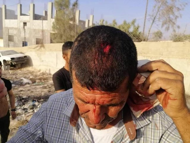 Farmer  injured in the head after settlers assault Asira al-Qibliya