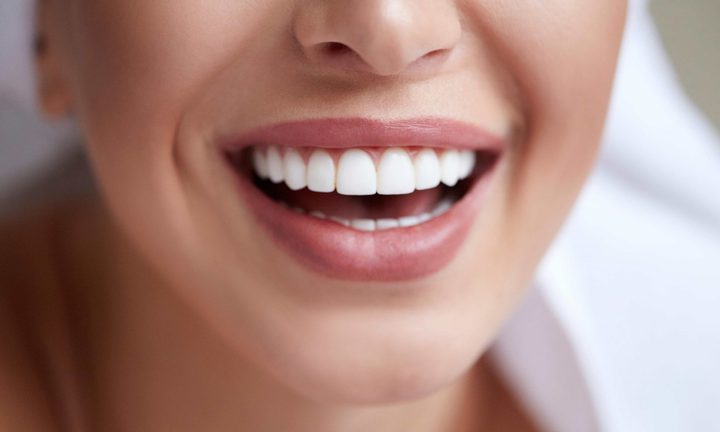 Lemon and soda are an effective way to whiten your teeth at home